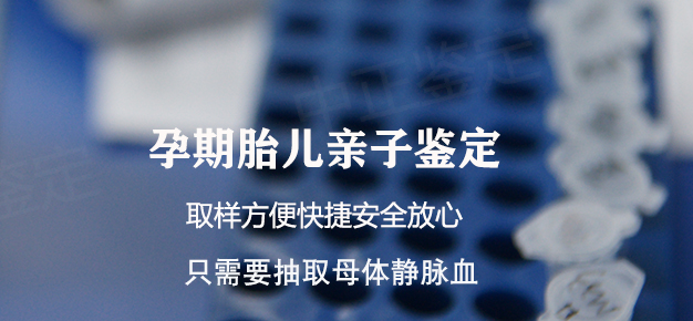 临沂产前亲子鉴定条件和材料,临沂孕期亲子鉴定结果需要多久