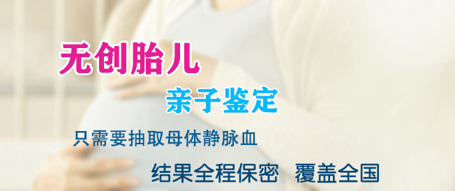 临沂孕期亲子鉴定中心出结果时间,临沂孕期亲子鉴定哪里能办理 临沂孕期亲子鉴定中心出结果时间,临沂孕期亲子鉴定哪里能办理